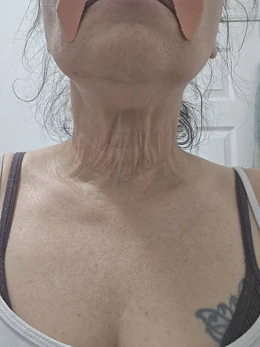 Ma peau du cou est bien plus tonique