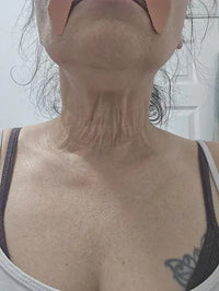 Ma peau du cou est bien plus tonique